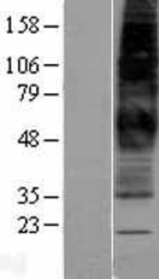 Western Blot: FPR1 Overexpression Lysate (Adult Normal) [NBP2-04212] Left-Empty vector transfected control cell lysate (HEK293 cell lysate); Right -Over-expression Lysate for FPR1.