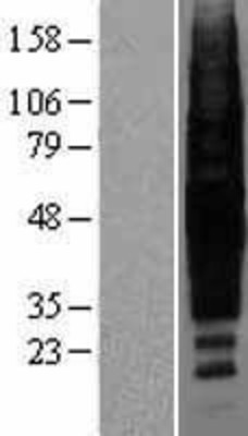 Western Blot: Rhodopsin Overexpression Lysate (Adult Normal) [NBP2-04162] Left-Empty vector transfected control cell lysate (HEK293 cell lysate); Right -Over-expression Lysate for Rhodopsin.