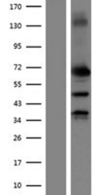 Western Blot: MMP2 Overexpression Lysate (Adult Normal) [NBP2-07861] Left-Empty vector transfected control cell lysate (HEK293 cell lysate); Right -Over-expression Lysate for MMP2.