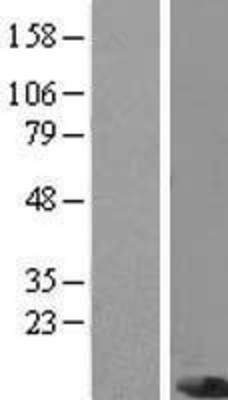 Western Blot: PIGC Overexpression Lysate (Adult Normal) [NBP2-08086] Left-Empty vector transfected control cell lysate (HEK293 cell lysate); Right -Over-expression Lysate for PIGC.