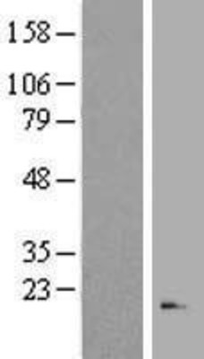 Western Blot: RNASE3 Overexpression Lysate (Adult Normal) [NBP2-08055] Left-Empty vector transfected control cell lysate (HEK293 cell lysate); Right -Over-expression Lysate for RNASE3.