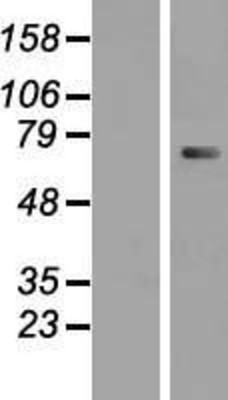Western Blot: CTNNAL1 Overexpression Lysate (Adult Normal) [NBP2-07952] Left-Empty vector transfected control cell lysate (HEK293 cell lysate); Right -Over-expression Lysate for CTNNAL1.
