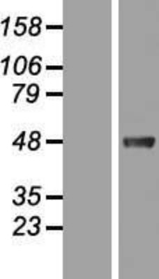 Western Blot: Pax2 Overexpression Lysate (Adult Normal) [NBP2-07926] Left-Empty vector transfected control cell lysate (HEK293 cell lysate); Right -Over-expression Lysate for Pax2.