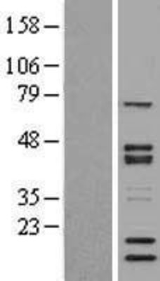 Western Blot: SNW1 Overexpression Lysate (Adult Normal) [NBP2-04331] Left-Empty vector transfected control cell lysate (HEK293 cell lysate); Right -Over-expression Lysate for SNW1.