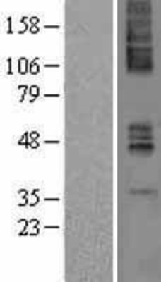 Western Blot: Muscarinic Acetylcholine Receptor M4 Overexpression Lysate (Adult Normal) [NBP2-04174] Left-Empty vector transfected control cell lysate (HEK293 cell lysate); Right -Over-expression Lysate for Muscarinic Acetylcholine Receptor M4.