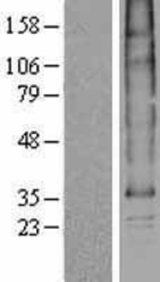 Western Blot: SLC35B1 Overexpression Lysate (Adult Normal) [NBP2-04301] Left-Empty vector transfected control cell lysate (HEK293 cell lysate); Right -Over-expression Lysate for SLC35B1.
