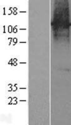 Western Blot: CHRNA6 Overexpression Lysate (Adult Normal) [NBP2-04267] Left-Empty vector transfected control cell lysate (HEK293 cell lysate); Right -Over-expression Lysate for CHRNA6.