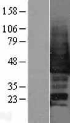 Western Blot: SAPK3 Overexpression Lysate (Adult Normal) [NBP2-04236] Left-Empty vector transfected control cell lysate (HEK293 cell lysate); Right -Over-expression Lysate for SAPK3.