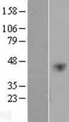 Western Blot: VEGFC Overexpression Lysate (Adult Normal) [NBP2-04293] Left-Empty vector transfected control cell lysate (HEK293 cell lysate); Right -Over-expression Lysate for VEGFC.