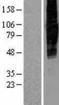 Western Blot: SLC34A2 Overexpression Lysate (Adult Normal) [NBP2-04311] Left-Empty vector transfected control cell lysate (HEK293 cell lysate); Right -Over-expression Lysate for SLC34A2.