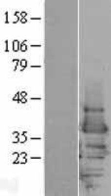Western Blot: 14-3-3 epsilon Overexpression Lysate (Adult Normal) [NBP2-04318] Left-Empty vector transfected control cell lysate (HEK293 cell lysate); Right -Over-expression Lysate for 14-3-3 epsilon.