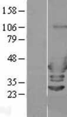Western Blot: ARFIP2 Overexpression Lysate (Adult Normal) [NBL1-07660] Left-Empty vector transfected control cell lysate (HEK293 cell lysate); Right -Over-expression Lysate for ARFIP2.