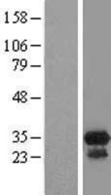 Western Blot: CCDC117 Overexpression Lysate (Adult Normal) [NBL1-08770] Left-Empty vector transfected control cell lysate (HEK293 cell lysate); Right -Over-expression Lysate for CCDC117.