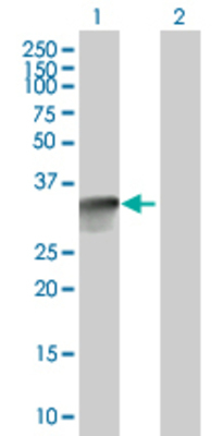 Lane 1: CDCA8 transfected lysate (30.91 KDa). Lane 2: Non-transfected lysate.