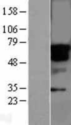 Western Blot: STK33 Overexpression Lysate (Adult Normal) [NBL1-16551] Left-Empty vector transfected control cell lysate (HEK293 cell lysate); Right -Over-expression Lysate for STK33.
