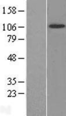 Western Blot: TrkB Overexpression Lysate (Adult Normal) [NBL1-13837] Left-Empty vector transfected control cell lysate (HEK293 cell lysate); Right -Over-expression Lysate for TrkB.