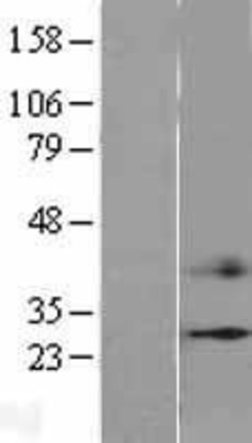 Western Blot: CIDEC Overexpression Lysate (Adult Normal) [NBL1-09207] Left-Empty vector transfected control cell lysate (HEK293 cell lysate); Right -Over-expression Lysate for CIDEC.