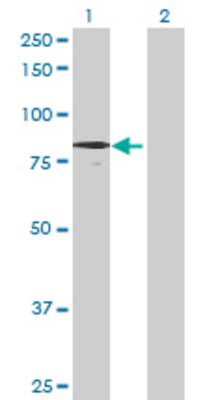Lane 1: GUSB transfected lysate (71.72 KDa) Lane 2: Non-transfected lysate.