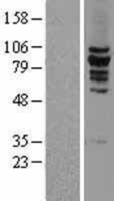 Western Blot: KIF2C Overexpression Lysate (Adult Normal) [NBL1-12294] Left-Empty vector transfected control cell lysate (HEK293 cell lysate); Right -Over-expression Lysate for KIF2C.