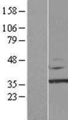 Western Blot: CAB39L Overexpression Lysate (Adult Normal) [NBP2-08473] Left-Empty vector transfected control cell lysate (HEK293 cell lysate); Right -Over-expression Lysate for CAB39L.