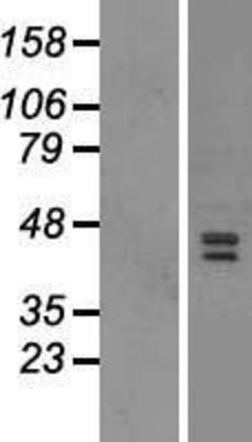 Western Blot: JMJD6 Overexpression Lysate (Adult Normal) [NBP2-08420] Left-Empty vector transfected control cell lysate (HEK293 cell lysate); Right -Over-expression Lysate for JMJD6.