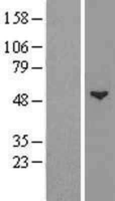 Western Blot: GCNT1 Overexpression Lysate (Adult Normal) [NBP2-08272] Left-Empty vector transfected control cell lysate (HEK293 cell lysate); Right -Over-expression Lysate for GCNT1.
