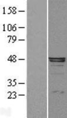 Western Blot: Alpha-1-Microglobulin Overexpression Lysate (Adult Normal) [NBL1-07495] Left-Empty vector transfected control cell lysate (HEK293 cell lysate); Right -Over-expression Lysate for Alpha-1-Microglobulin.