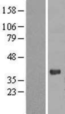 Western Blot: PGRP1A Overexpression Lysate (Adult Normal) [NBL1-14336] Left-Empty vector transfected control cell lysate (HEK293 cell lysate); Right -Over-expression Lysate for PGRP1A.