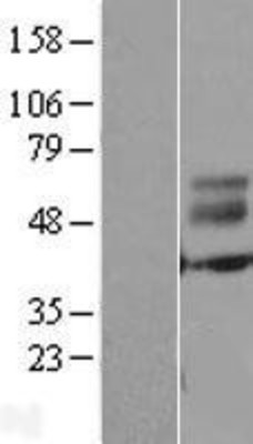 Western Blot: ERMN Overexpression Lysate (Adult Normal) [NBL1-10334] Left-Empty vector transfected control cell lysate (HEK293 cell lysate); Right -Over-expression Lysate for ERMN.