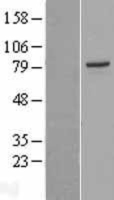 Western Blot: PAK5 Overexpression Lysate (Adult Normal) [NBL1-14085] Left-Empty vector transfected control cell lysate (HEK293 cell lysate); Right -Over-expression Lysate for PAK5.