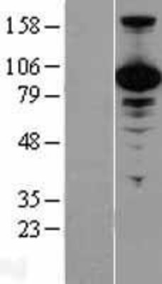 Western Blot: p97/VCP Overexpression Lysate (Adult Normal) [NBL1-17707] Left-Empty vector transfected control cell lysate (HEK293 cell lysate); Right -Over-expression Lysate for p97/VCP.