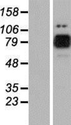Western Blot: MARK2 Overexpression Lysate (Adult Normal) [NBP2-07807] Left-Empty vector transfected control cell lysate (HEK293 cell lysate); Right -Over-expression Lysate for MARK2.
