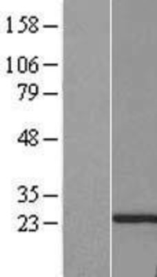 Western Blot: PTTG2 Overexpression Lysate (Adult Normal) [NBP2-07603] Left-Empty vector transfected control cell lysate (HEK293 cell lysate); Right -Over-expression Lysate for PTTG2.
