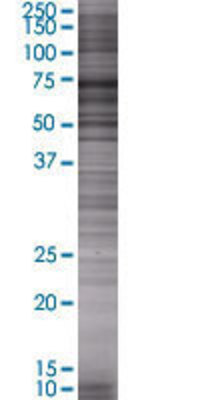 FOXJ2 transfected lysate.