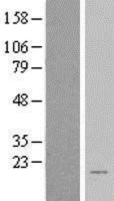 Western Blot: BEX2 Overexpression Lysate (Adult Normal) [NBL1-07971] Left-Empty vector transfected control cell lysate (HEK293 cell lysate); Right -Over-expression Lysate for BEX2.