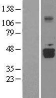 Western Blot: DDO Overexpression Lysate (Adult Normal) [NBL1-09775] Left-Empty vector transfected control cell lysate (HEK293 cell lysate); Right -Over-expression Lysate for DDO.