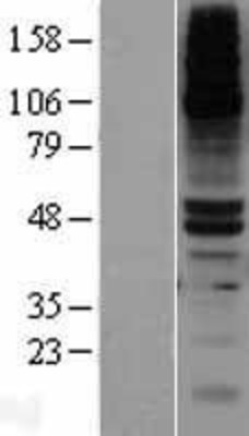 Western Blot: DPEP1 Overexpression Lysate (Adult Normal) [NBL1-09988] Left-Empty vector transfected control cell lysate (HEK293 cell lysate); Right -Over-expression Lysate for DPEP1.