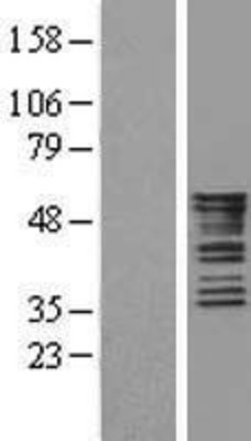 Western Blot: Cytokeratin 8 Overexpression Lysate (Adult Normal) [NBL1-12397] Left-Empty vector transfected control cell lysate (HEK293 cell lysate); Right -Over-expression Lysate for Cytokeratin 8.