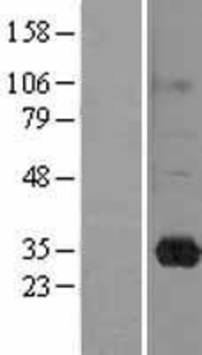 Western Blot: RASL11B Overexpression Lysate (Adult Normal) [NBL1-15174] Left-Empty vector transfected control cell lysate (HEK293 cell lysate); Right -Over-expression Lysate for RASL11B.