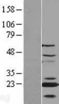 Western Blot: CENPN Overexpression Lysate (Adult Normal) [NBL1-09089] Left-Empty vector transfected control cell lysate (HEK293 cell lysate); Right -Over-expression Lysate for CENPN.