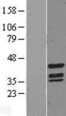 Western Blot: TIN2 Overexpression Lysate (Adult Normal) [NBL1-16930] Left-Empty vector transfected control cell lysate (HEK293 cell lysate); Right -Over-expression Lysate for TIN2.