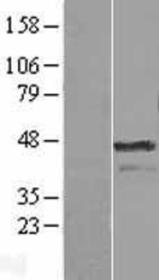 Western Blot: Aurora A Overexpression Lysate (Adult Normal) [NBL1-07856] Left-Empty vector transfected control cell lysate (HEK293 cell lysate); Right -Over-expression Lysate for Aurora A.