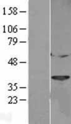 Western Blot: Cathepsin L Overexpression Lysate (Adult Normal) [NBL1-09594] Left-Empty vector transfected control cell lysate (HEK293 cell lysate); Right -Over-expression Lysate for Cathepsin L.