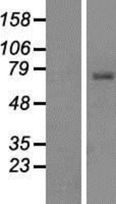 Western Blot: TCIRG1 Overexpression Lysate (Adult Normal) [NBP2-09827] Left-Empty vector transfected control cell lysate (HEK293 cell lysate); Right -Over-expression Lysate for TCIRG1.
