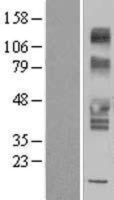 Western Blot: SLC43A3 Overexpression Lysate (Adult Normal) [NBP2-10098] Left-Empty vector transfected control cell lysate (HEK293 cell lysate); Right -Over-expression Lysate for SLC43A3.