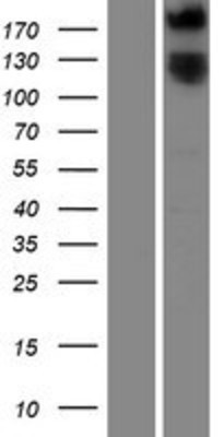 Western Blot: Robo1 Overexpression Lysate (Adult Normal) [NBP2-09764] Left-Empty vector transfected control cell lysate (HEK293 cell lysate); Right -Over-expression Lysate for Robo1.