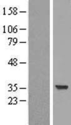 Western Blot: SULT2A1 Overexpression Lysate (Adult Normal) [NBL1-16607] Left-Empty vector transfected control cell lysate (HEK293 cell lysate); Right -Over-expression Lysate for SULT2A1.
