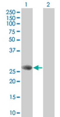 Lane 1: STXBP4 transfected lysate (27.06 KDa). Lane 2: Non-transfected lysate.
