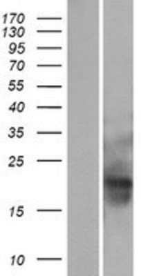 Western Blot: MID1IP1 Overexpression Lysate (Adult Normal) [NBP2-09898] Left-Empty vector transfected control cell lysate (HEK293 cell lysate); Right -Over-expression Lysate for MID1IP1.