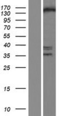 Western Blot: SETDB1 Overexpression Lysate (Adult Normal) [NBP2-09749] Left-Empty vector transfected control cell lysate (HEK293 cell lysate); Right -Over-expression Lysate for SETDB1.